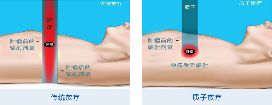 07_科普家園-什么是質子治療(5).jpg